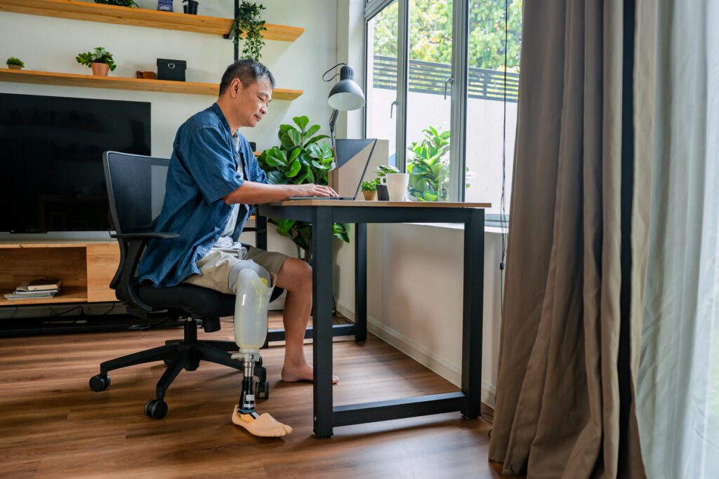 Man with prosthetic leg working on laptop at home